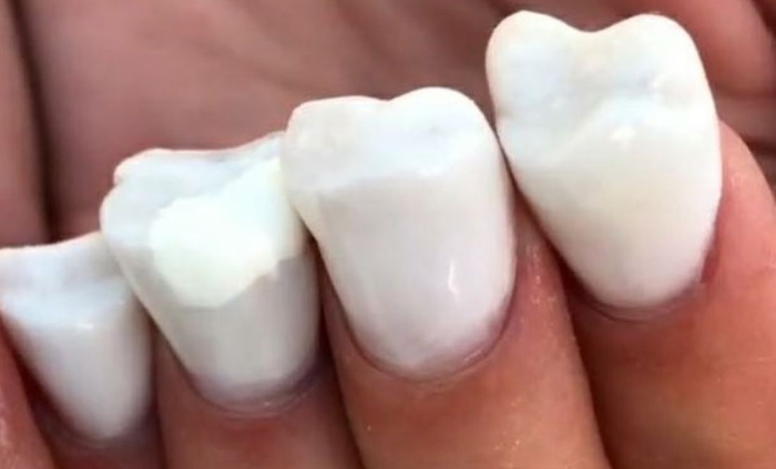 Crean uñas con forma de dientes y se vuelve viral