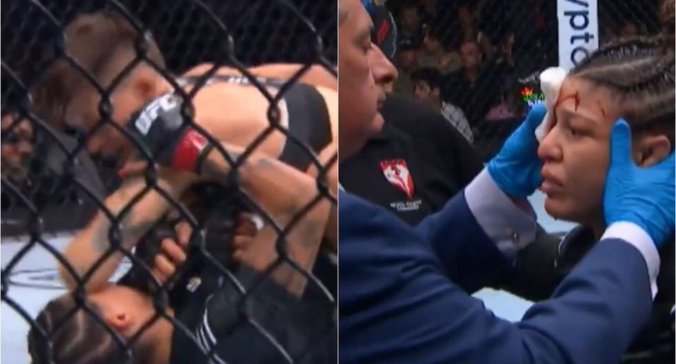 VIDEO: UFC Girls’s Battle Stopped As a result of Horrible Facial Wound