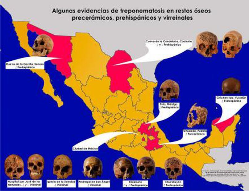 Exposición Revisa Las Infecciones Sexuales En Restos óseos Antiguos De México 1935