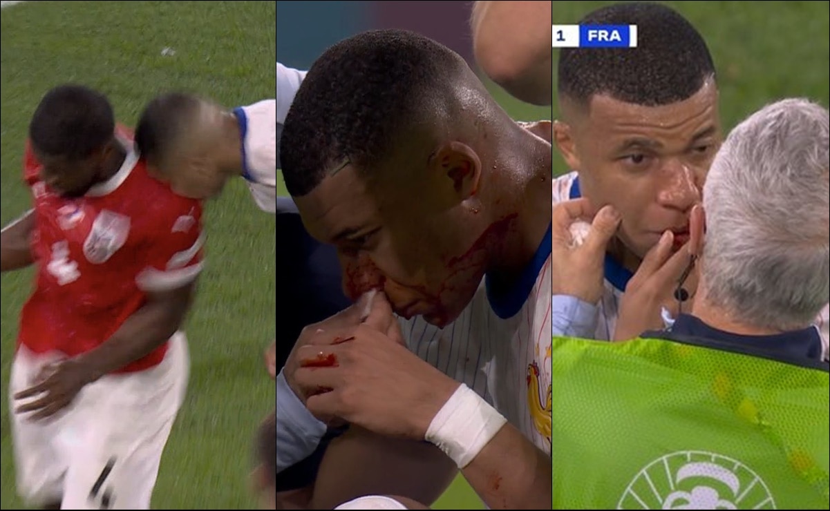 ¿Fracturado? Kylian Mbappé sufrió brutal golpe en la nariz y preocupa a Francia y al Real Madrid