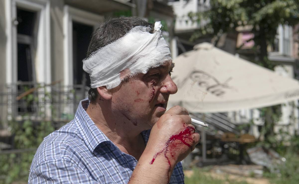 Un hombre herido con una gasa alrededor de la cabeza fuma tras un ataque con misiles en Kiev. Foto: EFE