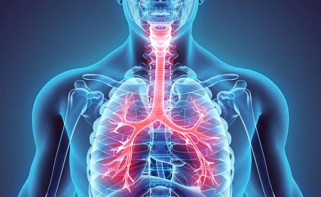 La obstrucción de las vías respiratorias puede ser causada por obstrucción de cuerpos extraños, sofocación o algún tipo de asfixia, la cual sugiere un fallo de la respiración pulmonar. Foto: Especial