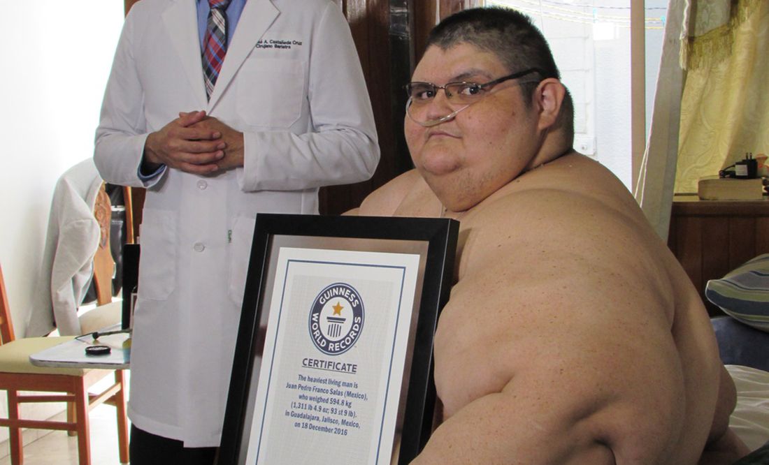 Hombre baja 72 kilos en dos años, documentó su pérdida de peso con
